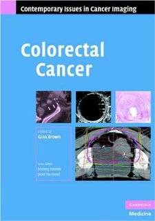 CancerNews   Colon Cancer Book Section   Colon Cancer Books