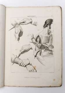 1832 France SURGERY MEDICINE w. Engravings Atlas RARE  