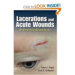  Lacerations and Acute Wounds An Evidence Based Guide 