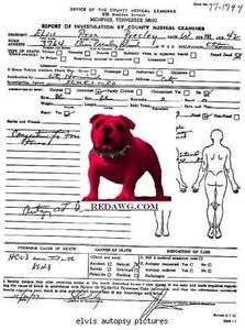   Rock & Roll Music Star Medical Examiners Autopsy Report 2pg  